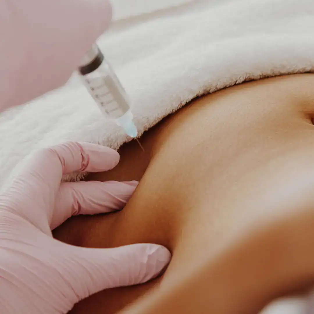 Tratamento com enzimas para gordura localizada com dermatologista perto de mim em SP