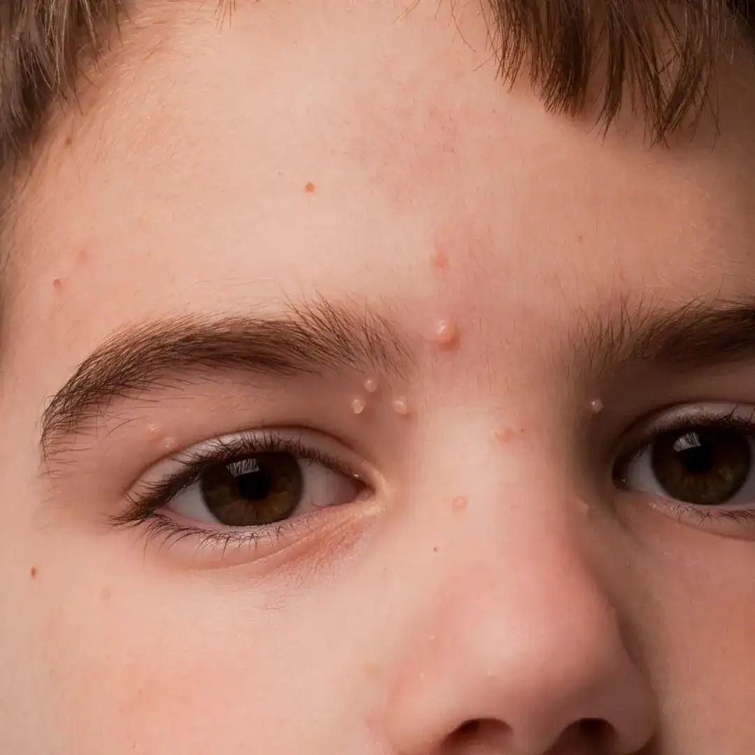 Dermatologista pediátrico. Dermatologia pediátrica
