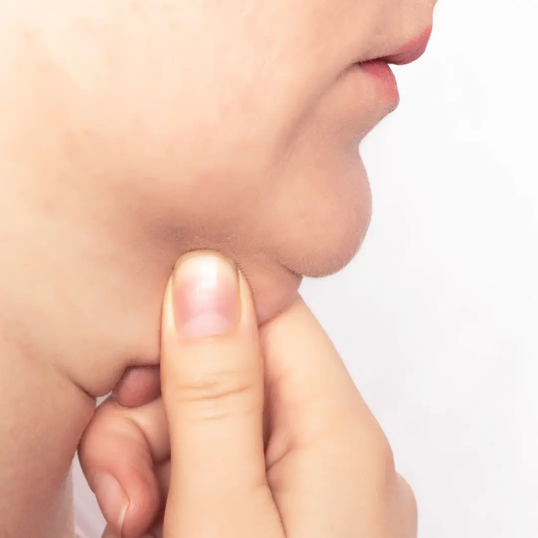 Tratamento para papada com dermatologista perto de mim em SP