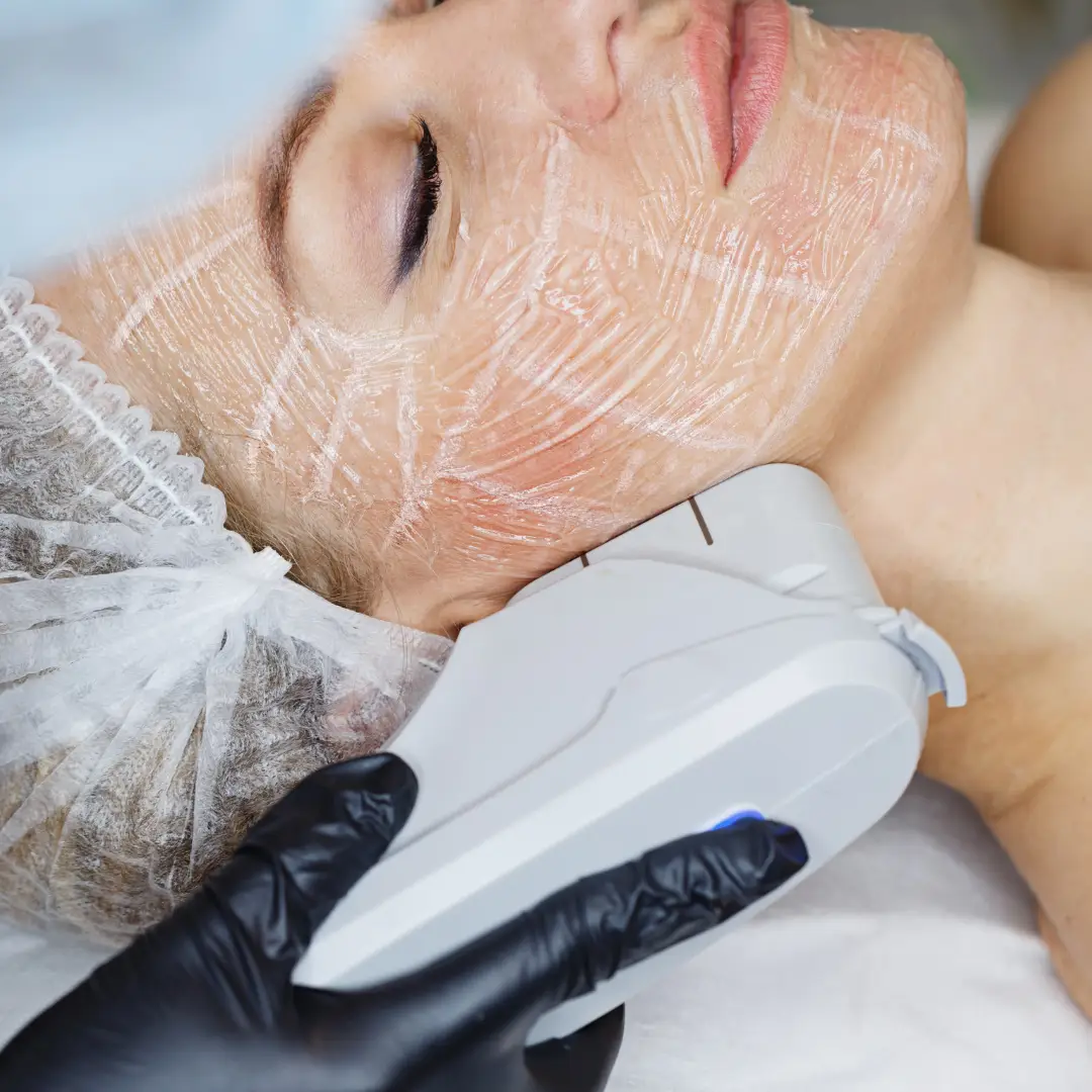 Liftera em Sp. Ultrassom microfocado em SP. Dermatologista perto de mim. Dermatologista em SP. Dermato