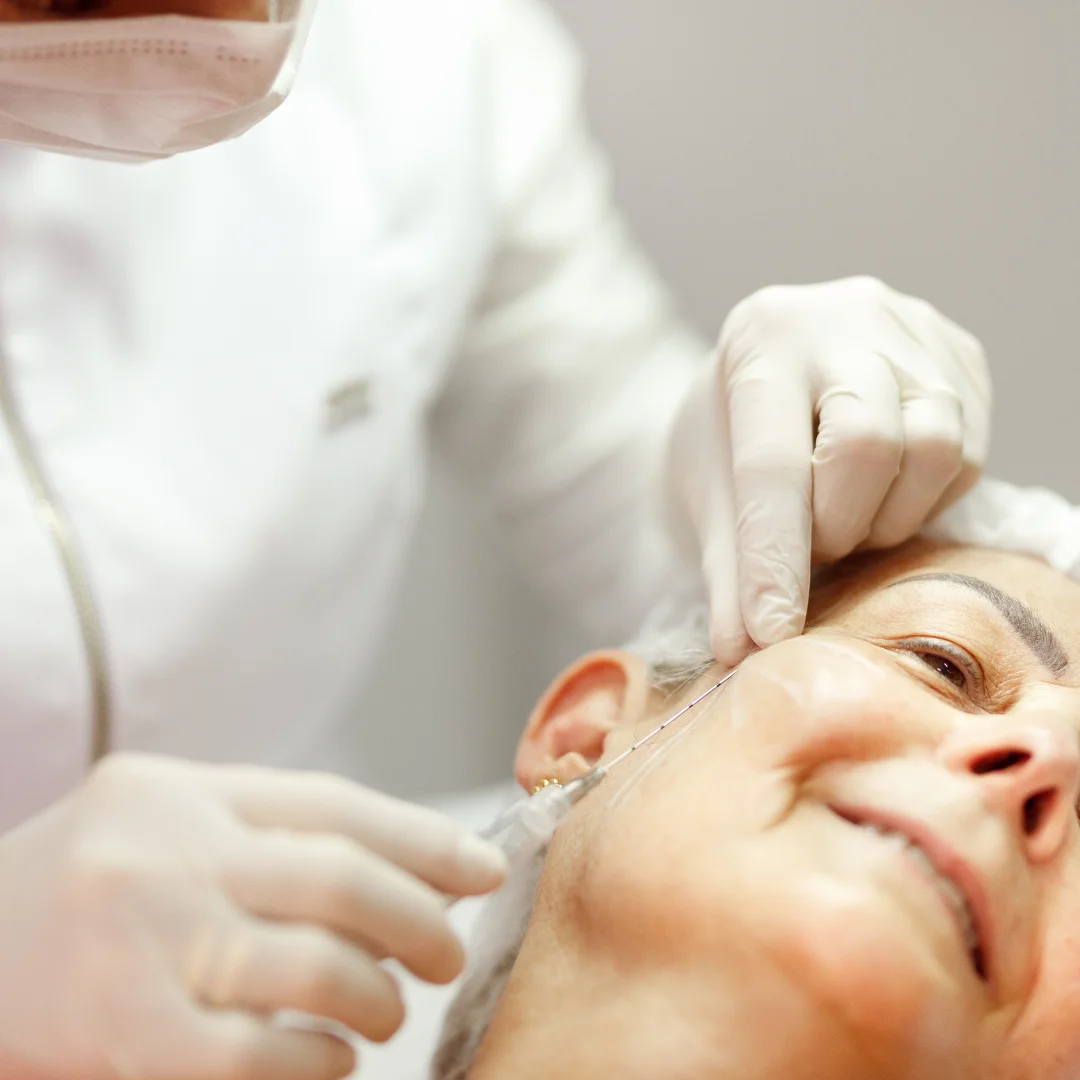 Bioestimulador com dermatologista em São Paulo- SP