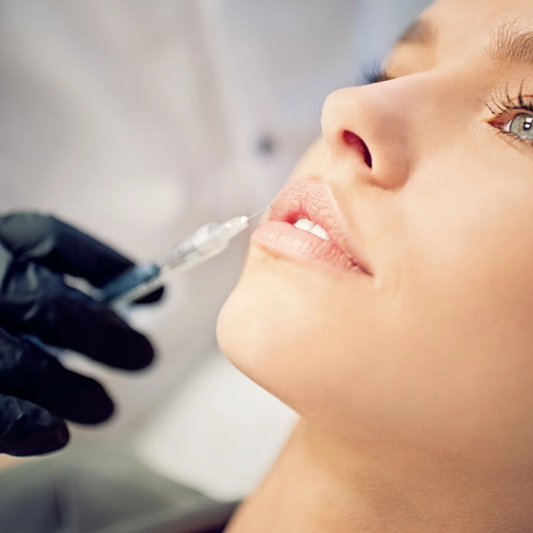 Preenchimento facial com Dermatologista em São paulo- SP