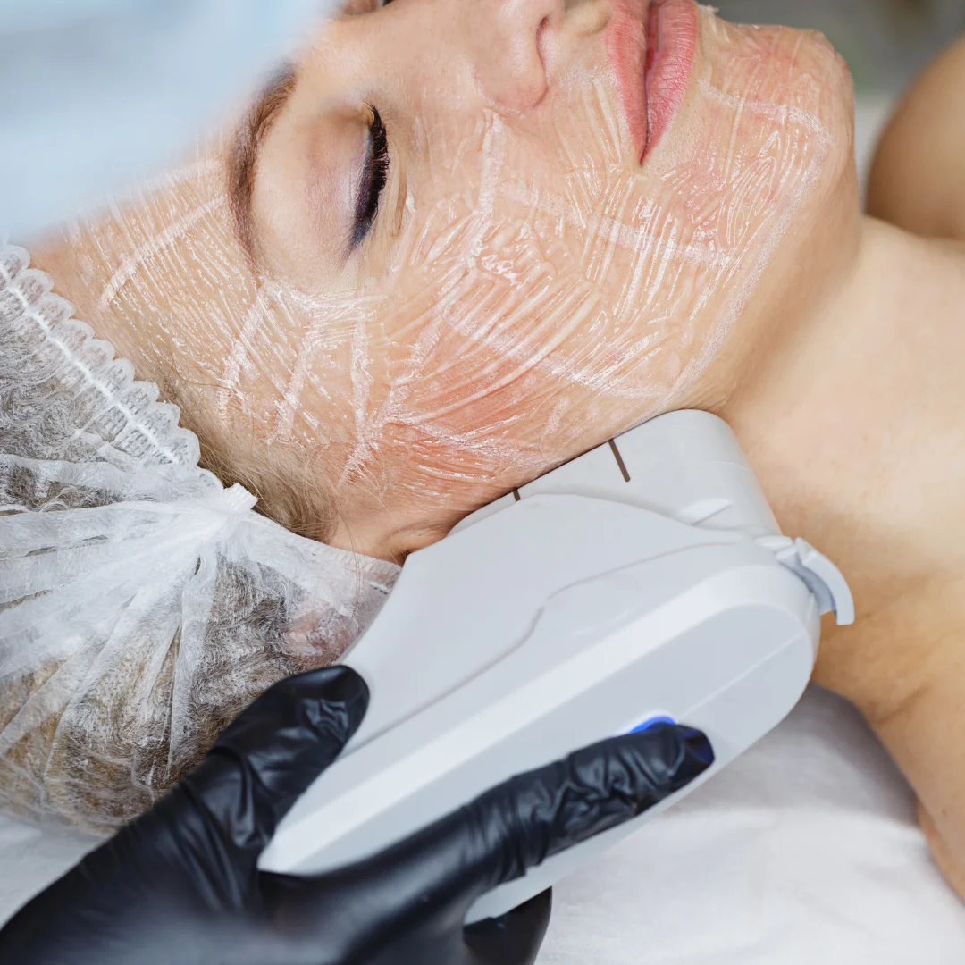 Liftera em Sp. Ultrassom microfocado em SP. Dermatologista perto de mim. Dermatologista em SP. Dermato